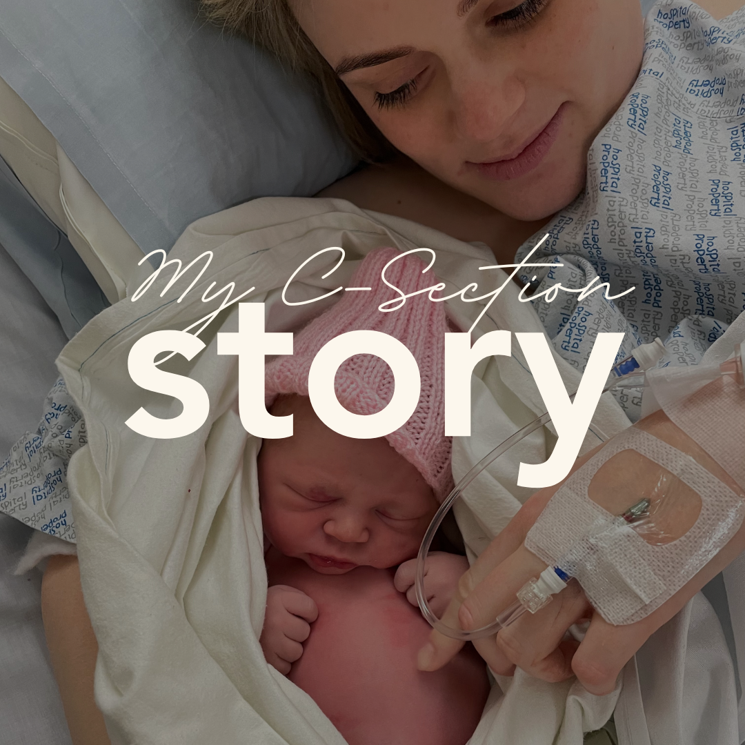 My C-Section Story